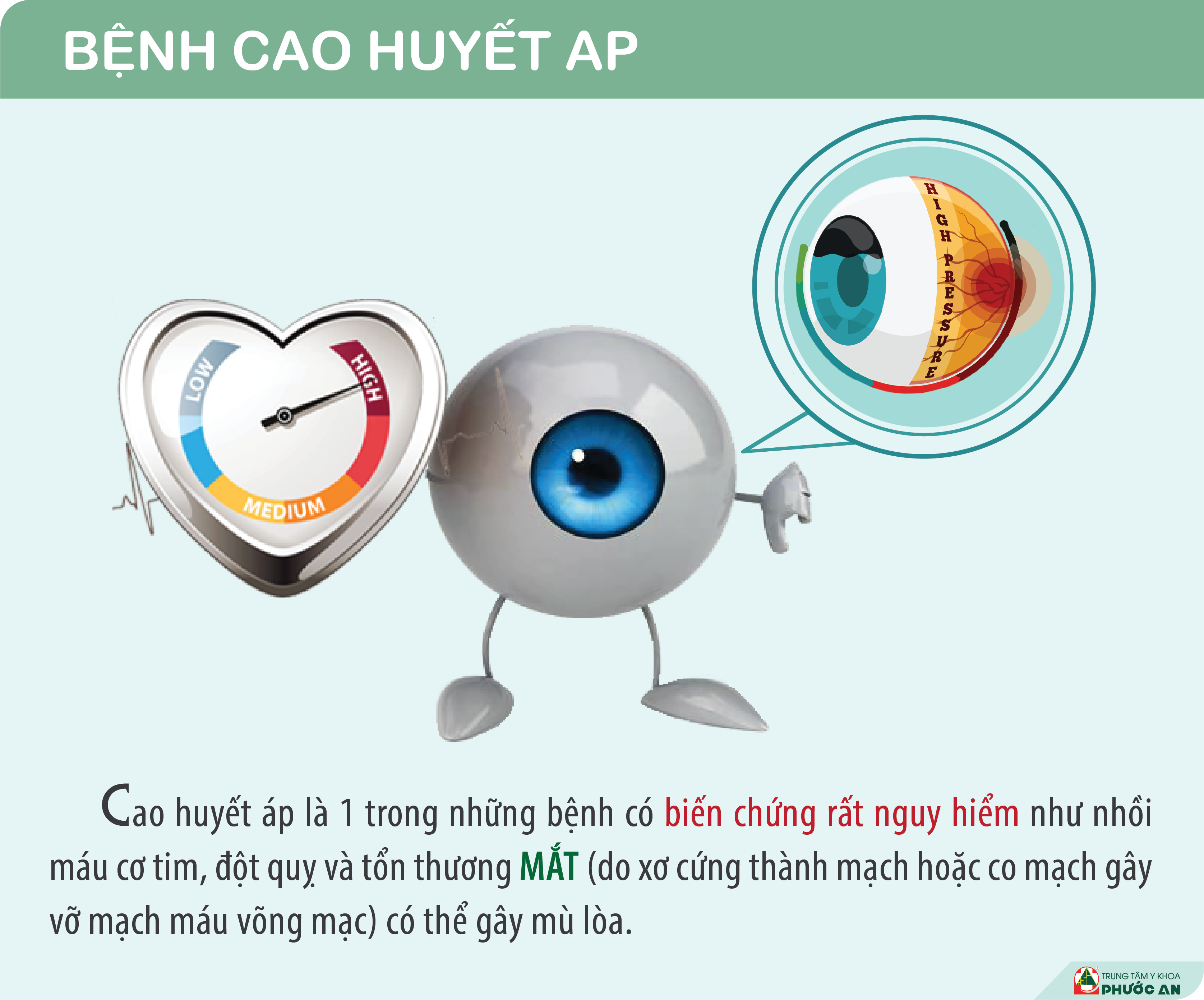 benh-cao-huyet-ap-anh-huong-mat