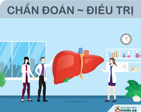 chan-doan-dieu-tri-xo-gan