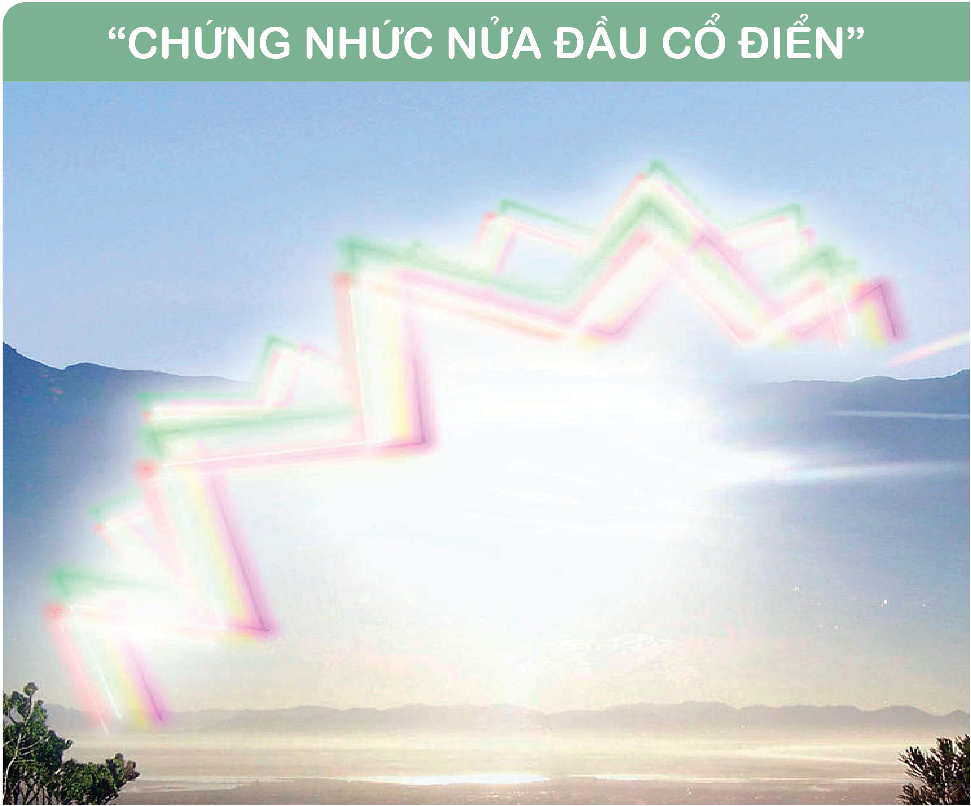 chung-dau-nhuc-nua-dau-co-dien
