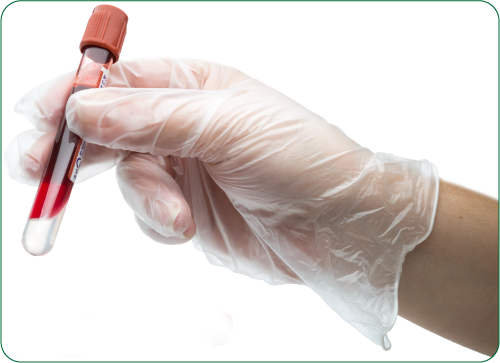 xét nghiệm máu chẩn đoán chấn thương